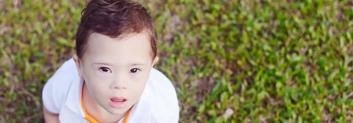 Inclusão da Criança com Síndrome de Down Inclusão da Criança com Síndrome de Down